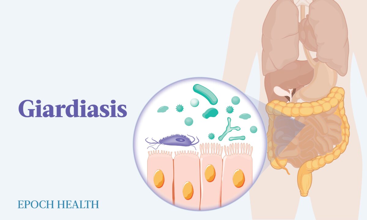 The Essential Guide To Giardiasis Symptoms Causes Treatments And