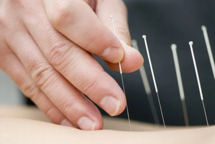 Sometimes releasing old trauma can be the cure for chronic pain, and sometimes all it takes is an intensive series of acupuncture treatments. (Courtesy of Photos.com)