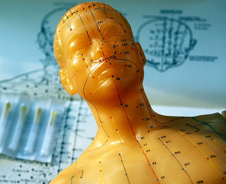 Acupuncturists need to be able to see the body through “quantum glasses” in order to understand this ancient system of treatment. (Credit: Cat Rooney/The Epoch Times)