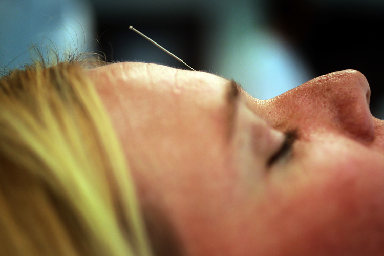 Getting diagnosed with breast cancer is a stressful experience that can often be helped with alternative treatments such as acupuncture.(Joe Raedle/Getty Images)