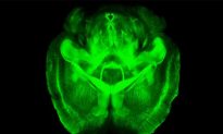 New Research: Transparent Mouse Brains