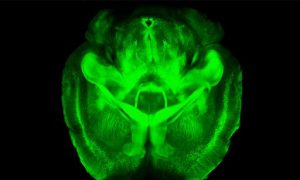 New Research: Transparent Mouse Brains 