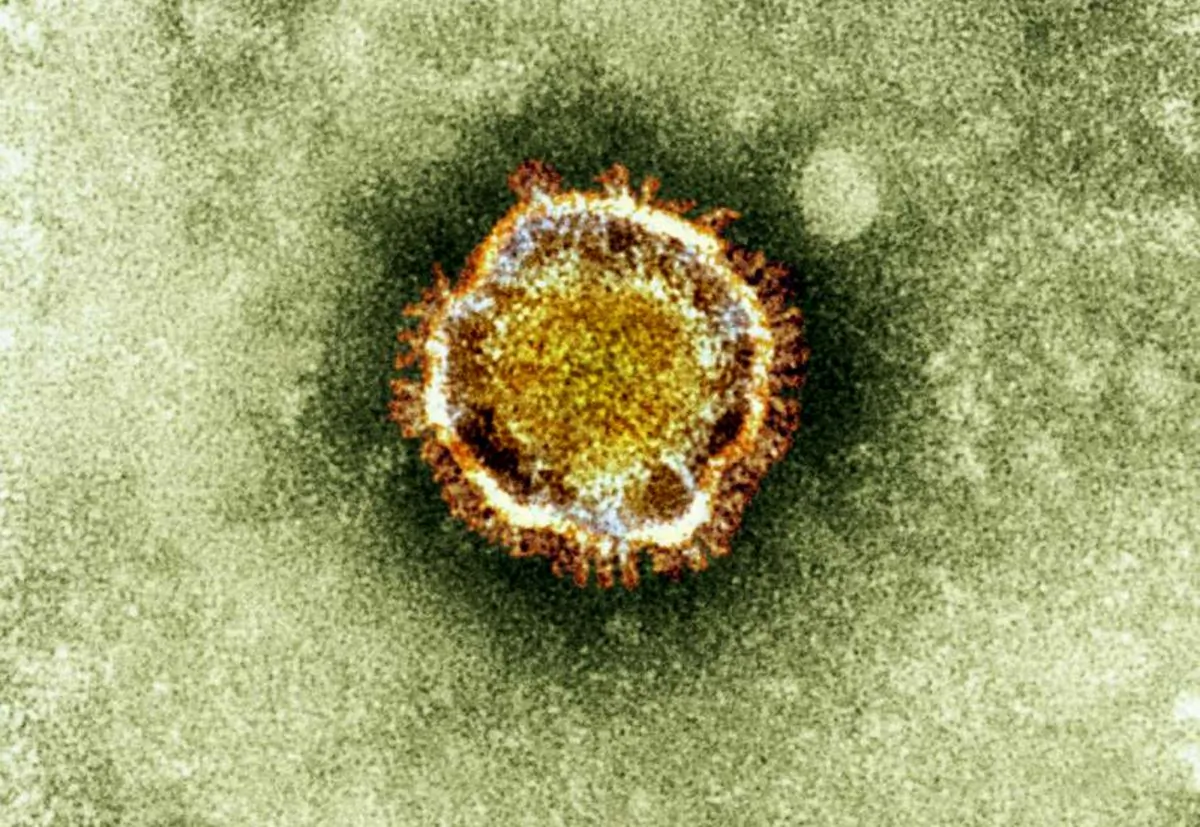In this undated file image released by the British Health Protection Agency shows an electron microscope image of a coronavirus, part of a family of viruses that cause ailments including the common cold and SARS, which was first identified last year in the Middle East. (AP Photo/Health Protection Agency, File) 