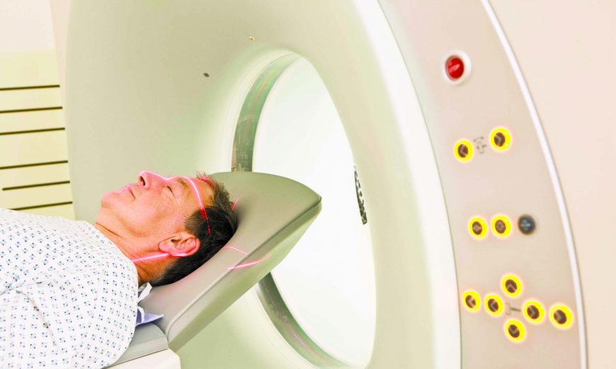 How Many Patients Would Agree to 500 Chest Xrays?