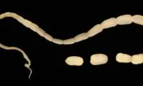 Florida Man Diagnosed With Pork Tapeworm Inside Left Eye
