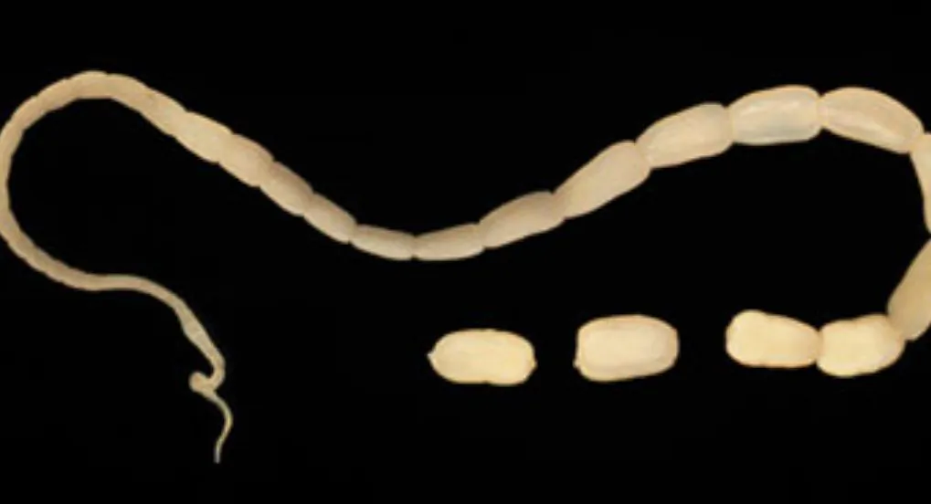 A tapeworm (dpd.cdc.gov)