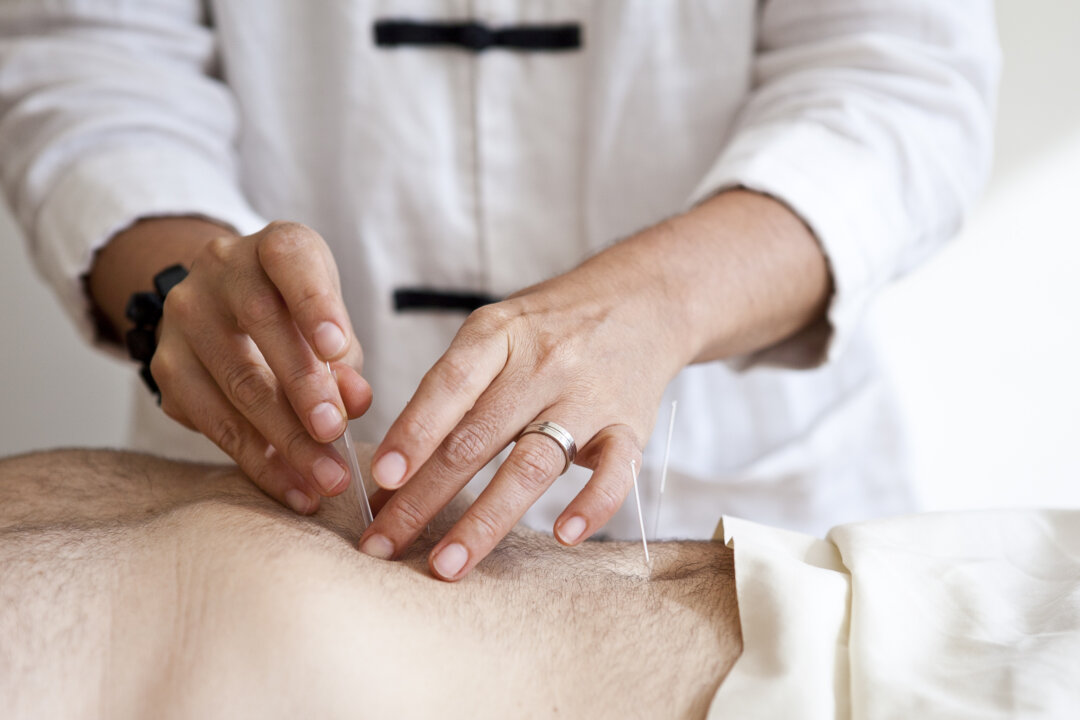 Acupuncture can very effectively regulate imbalances of the body’s energy.  (Samira Bouaou/Epoch Times)