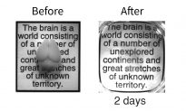 Breakthrough Method Turns Brain Invisible