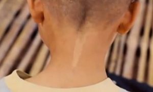 Are Birthmarks Connected to Violent Death in Past Life?