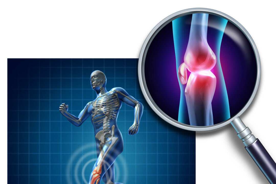 Osteoarthritis is the most common form of arthritis and occurs with the wearing down of flexible tissue at the ends of bones. (Courtesy of Karena Wu)