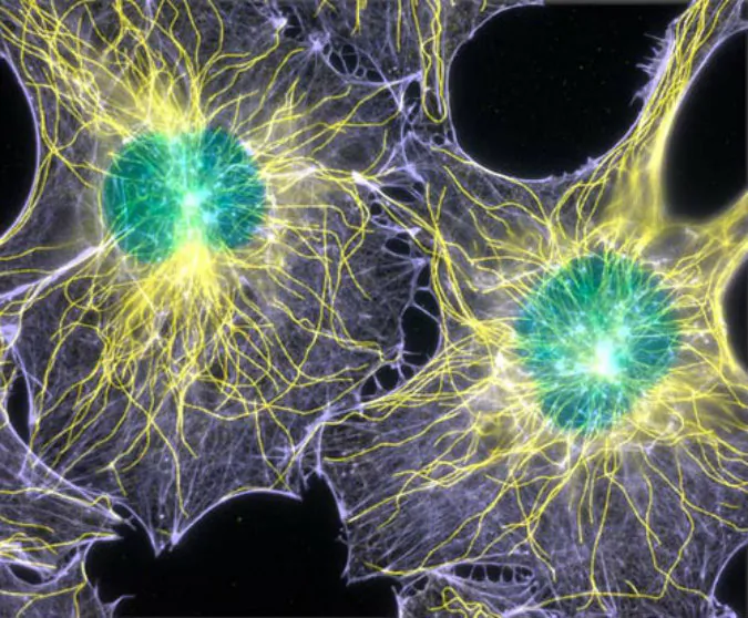 Protein microtubule: Fluorescence speckle microscopy, which tags a fraction of a protein, can improve image focus and the visibility of structures and dynamics in thick regions of living cells. Here, speckle microscopy illuminates the intricate network of microtubule (yellow) and actin filament (purple) fibers that builds a cell's structure. (Torsten Wittmann, UCSF)