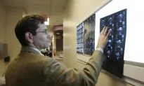 Brain Scans a $1 Billion Headache