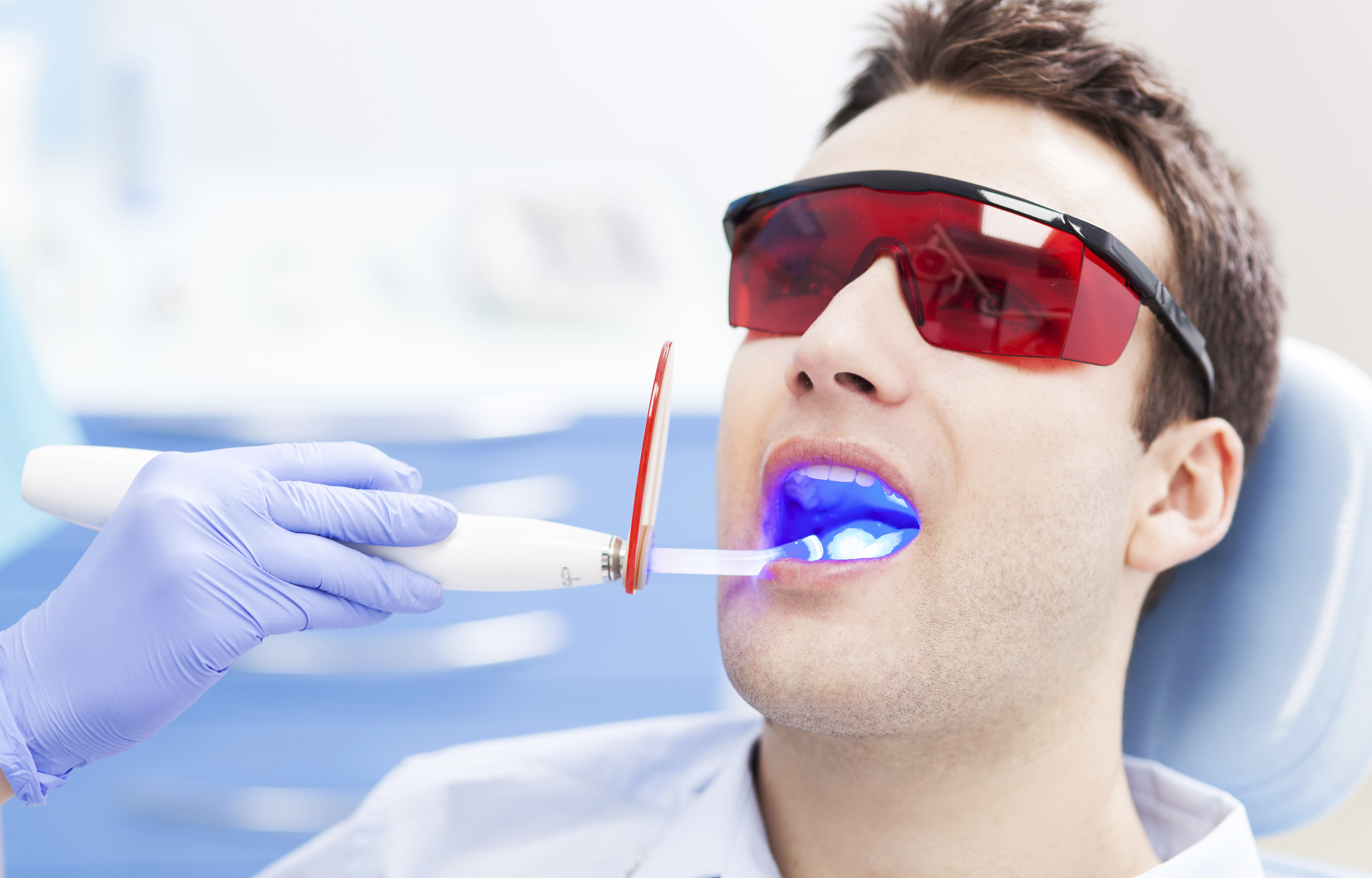 Стоматологическое отбеливание зубов. Лазерное отбеливание зубов. Отбеливание зубов в стоматологии. Профессиональное отбеливание зубов.