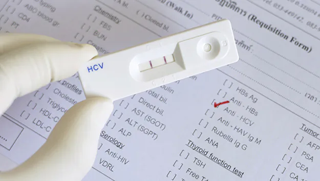 Appeals Court Upholds Rationing of Hepatitis C Treatment