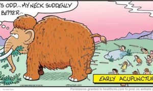 Acupuncture Points Gettin' Real