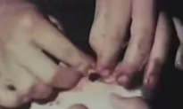 ‘Psychic Surgeons’ Say They Can Operate With Bare Hands