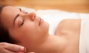  Acupuncture Helps Relieve Headache and Back Pain, Study Shows