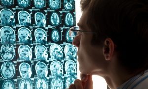 Top 10 Most Unhealthy, Cancer-Causing Foods - Never Eat These Again!