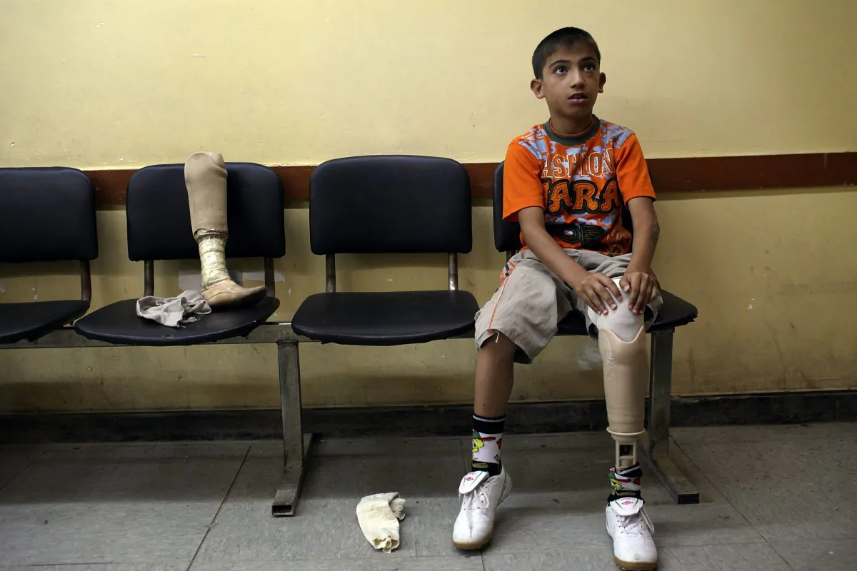 Ten-year-old Ali Mazin in Baghdad, Iraq, on July 11, 2011, tries on a new prosthetic leg after losing his in a car bombing in 2007. Residents of six Sunni-majority provinces in Iraq have staged peaceful sit-ins since late 2012. They accuse Iraqi Prime Minister Nouri al-Maliki of mass murder, blatant discrimination to favour Shias, and acting more like a criminal gang than a government during eight years in power. (Spencer Platt/Getty Images) 