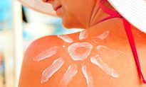Treat and Prevent Your Sunburns with These 6 Simple Ingredients