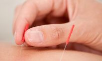 Acupuncture Needle Qi Sensation Revealed