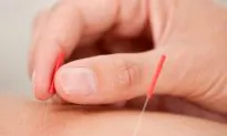 Acupuncture Needle Qi Sensation Revealed