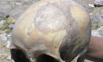 8,000-Year-Old Skull With Preserved Brain Matter Found in Norway