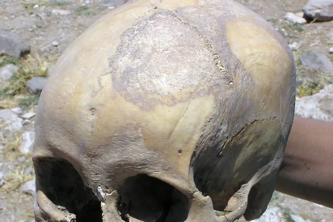 File photo of the excavation of a skull. (Shutterstock*)