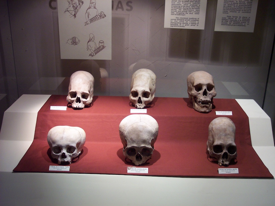 A case of skulls from the Andean Paracas culture, as seen in the National Museum of the Archaeology, Anthropology, and History of Peru. (Wikimedia Commons)