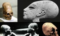 A Look at Theories About Elongated Skulls in Ancient Peru, Europe, Egypt