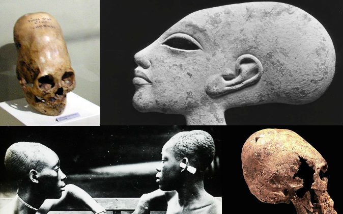 Headshave Slave - A Look at Theories About Elongated Skulls in Ancient Peru, Europe, Egypt |  The Epoch Times
