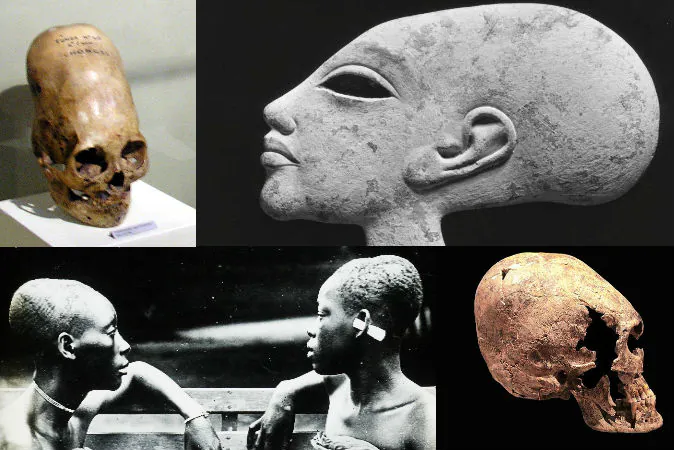 Top left: An elongated skull from Paracas, Peru. Top right: This female head has an elongated skull, and is probably a child of Egyptian Pharaoh Akhenaten (1351–1334 B.C.). Bottom left: Slave girls in the Congo, whose heads have been elongated through binding at a young age, ca. 1900–1915. Bottom right: Elongated skull of a young woman on display at Yverdon History museum. (Wikimedia Commons)
