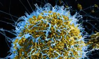 What Happens to Your Body When You Get Ebola?