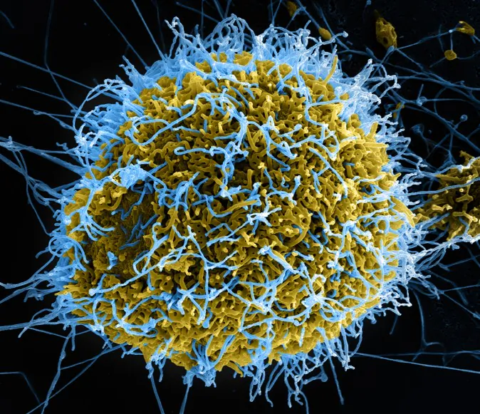 Ebola might be happy but you won’t be. ( NIAID, CC BY 2.0)