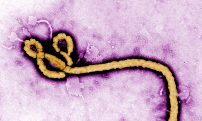 In this handout from the Center for Disease Control (CDC), a colorized transmission electron micrograph (TEM) of a Ebola virus virion is seen. The Ebola virus continues to spread across parts of Africa. (Center for Disease Control (CDC) via Getty Images)