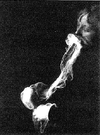 Ectoplasm
