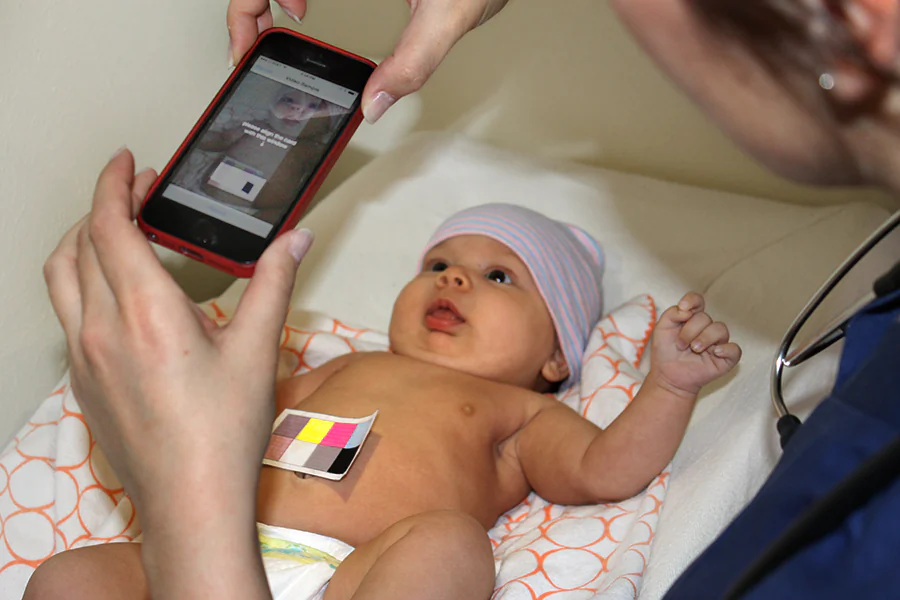 The BiliCam smartphone app provides an accurate and affordable way to screen for jaundice, a condition that is common in newborns. (Courtesy of Southern Methodist University)