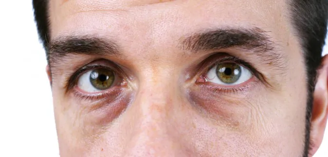 How to Detect Nutritional Deficiencies (Infographic)