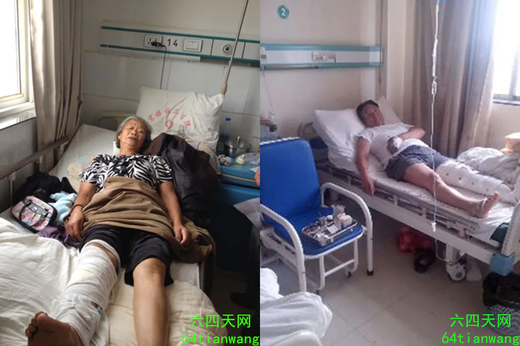 Left: 73 year-old Liu Daolan suffered violent attack on August 11 in Nanjing of Jiangsu Province after petitioned her grievance to the central inspection patrol, in a screenshot from 64tianwang.com. She suffers multiple fractures in the leg below the knee from the attack. Right: Liu Tonglin, who is over 60 years old, was violently attacked by two men after he appealed grievance to the central inspection team in Nanjing of Jiangsu Province on August 12, shown in a screenshot from 64tianwang.com. Liu suspects that the local authorities hired gangsters to attack him. (Epoch Times)