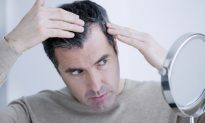 7 Natural Ways to Prevent Hair Loss