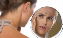 8 Ways to Naturally Prevent Wrinkles (Infographic)