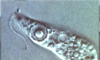 Killer Amoeba Found in Louisiana Water System (Video)