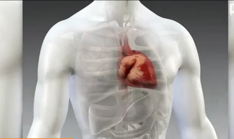 New Drug Could Reduce Cardiovascular Deaths (Video)