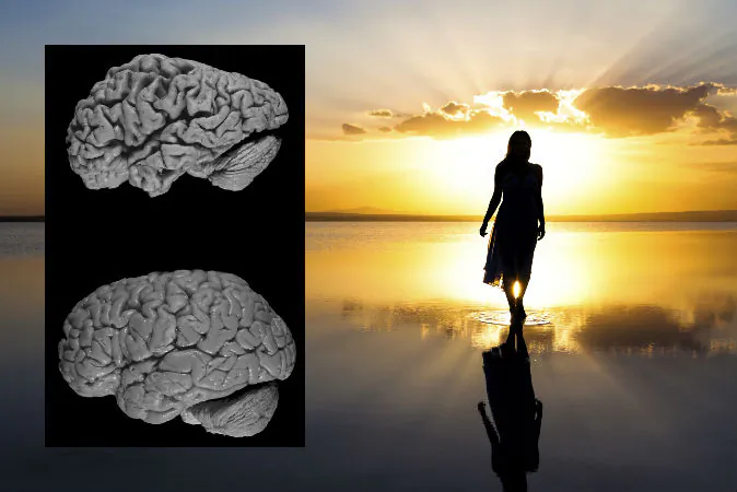A brain affected by Alzheimer's disease (above) and a healthy brain (below).(Hersenbank/Wikimedia Commons; image of a woman walking on the beach by BERKO85/iStock/Thinkstock)