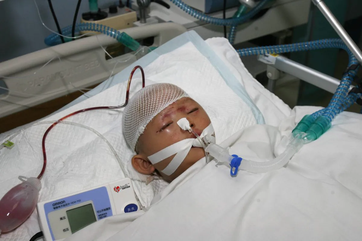 A two-year-old girl nicknamed Yue Yue is treated at a hospital in Guangzhou on Oct. 16, 2011, after being crushed by two vehicles and then ignored by 18 onlookers in the city of Foshan. The incident triggered soul searching in China about the cause of the country's moral breakdown, which was the subject of a recent official inquiry. (STR/AFP/Getty Images)