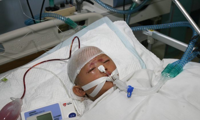 A two-year-old girl nicknamed Yue Yue is treated at a hospital in Guangzhou on Oct. 16, 2011, after being crushed by two vehicles and then ignored by 18 onlookers in the city of Foshan. The incident triggered soul searching in China about the cause of the country's moral breakdown, which was the subject of a recent official inquiry. (STR/AFP/Getty Images)