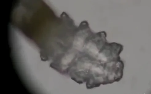 We All Have Mites Living On Our Faces (Video)