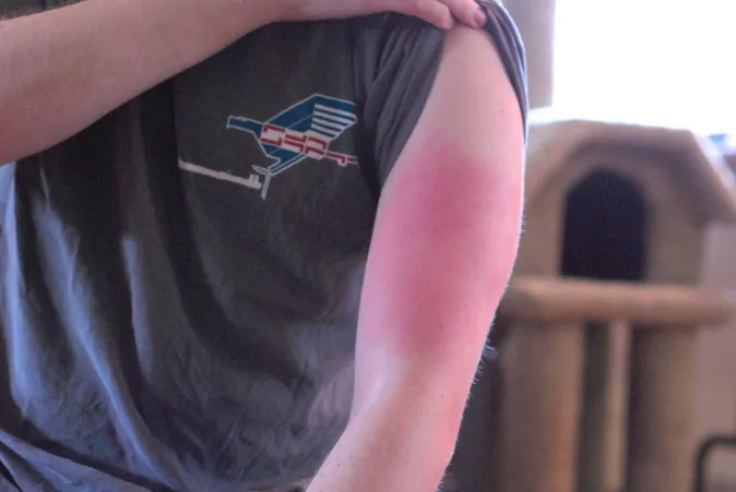 (Arm Reaction, CC BY-SA 2.0)
