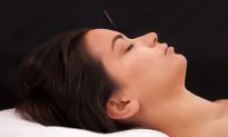 Acupuncture Relieves Migraines