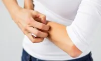 Why Scratching Makes You Itch More